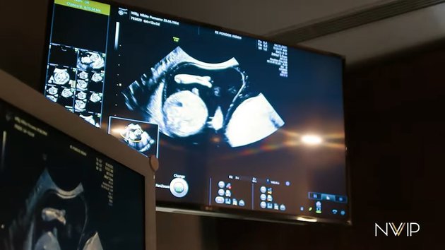 9 Momen Nikita Willy jalani USG, tingkah Indra Priawan curi atensi