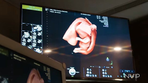 9 Momen Nikita Willy jalani USG, tingkah Indra Priawan curi atensi