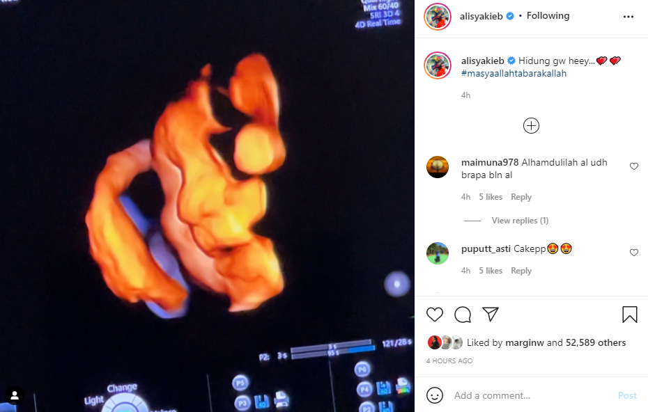 Unggah foto USG, Margin Wieheerm ungkap jenis kelamin calon bayinya