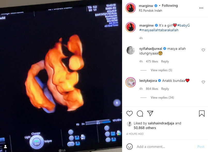 Unggah foto USG, Margin Wieheerm ungkap jenis kelamin calon bayinya