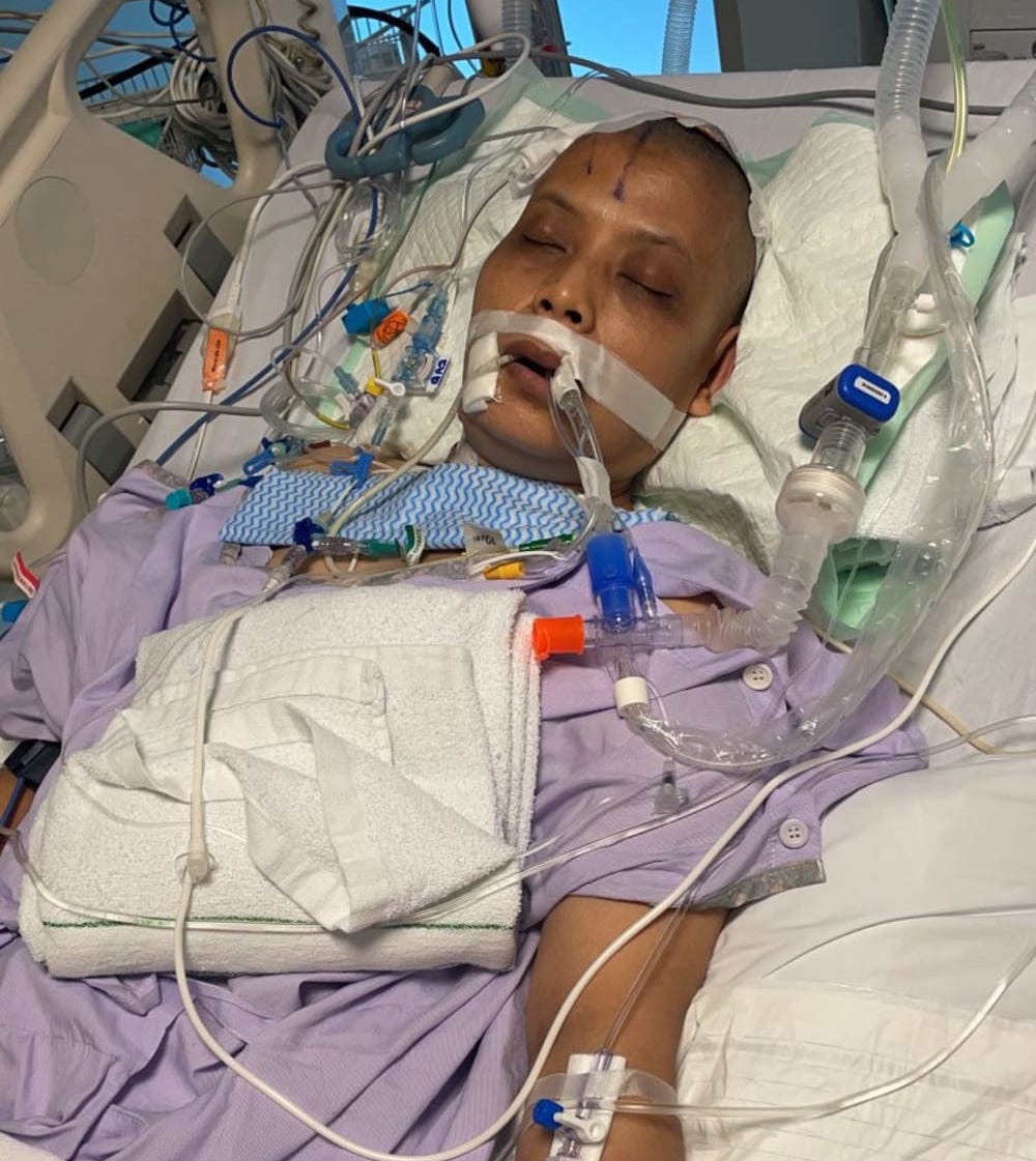 Kisah haru keluarga galang dana untuk ART yang sakit aneurisma otak