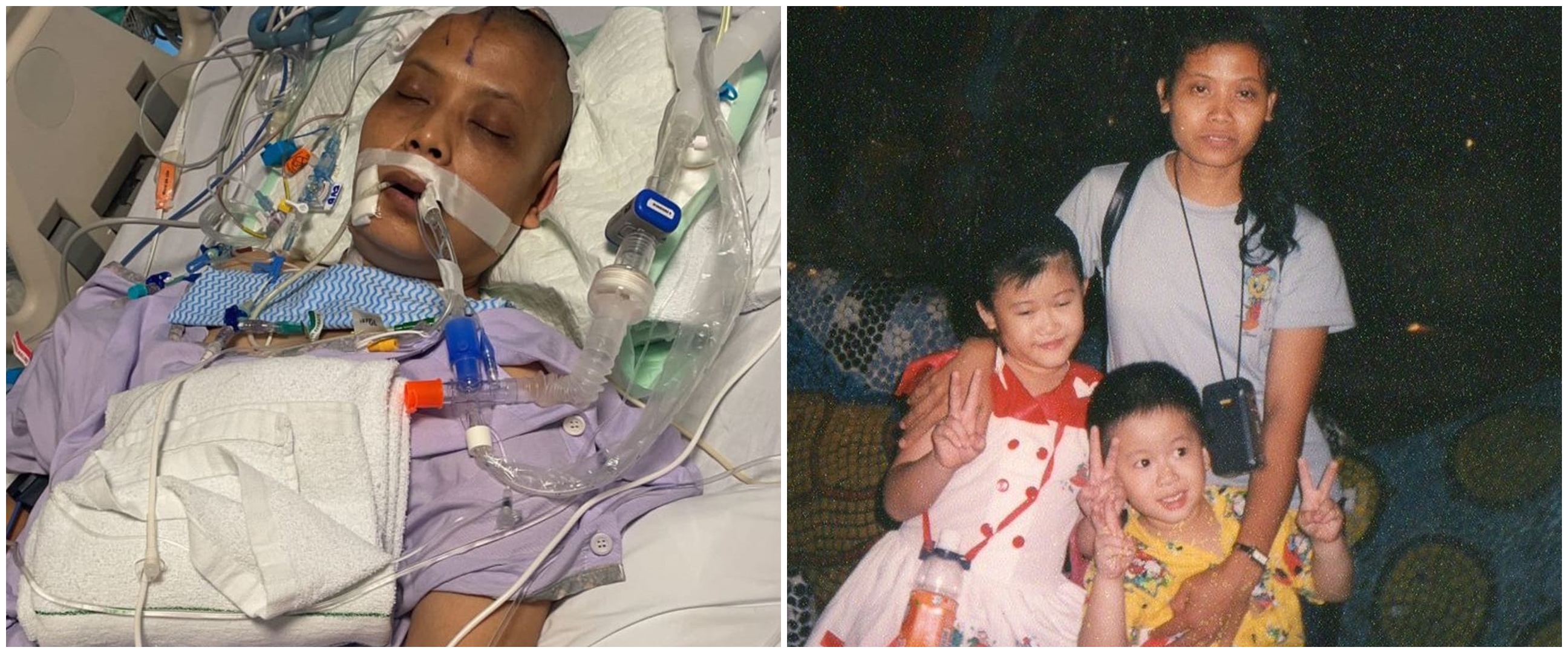 Kisah haru keluarga galang dana untuk ART yang sakit aneurisma otak