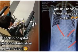 Cerita ibu hadapi anak menelan 6 baterai, panik lihat hasil X-Ray