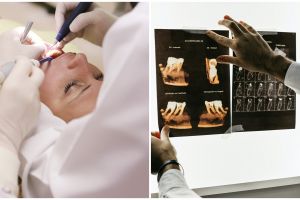 Berawal dari veneer gigi, wajah wanita ini berakhir lumpuh sebelah