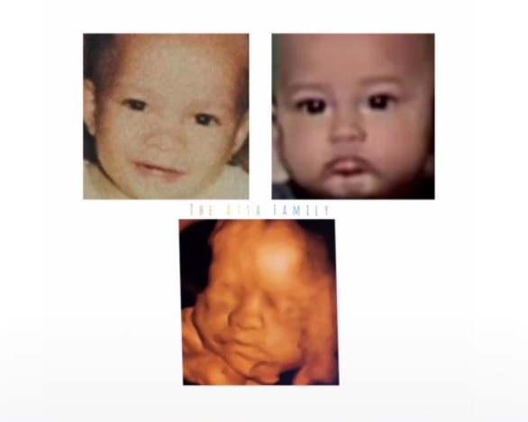 Aurel unggah foto USG terbaru, paras calon bayi disebut mirip Atta