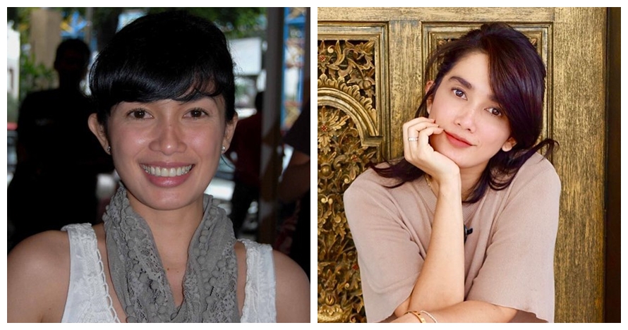 Potret 9 penyanyi sebelum dan sesudah tanam benang, pipi makin tirus