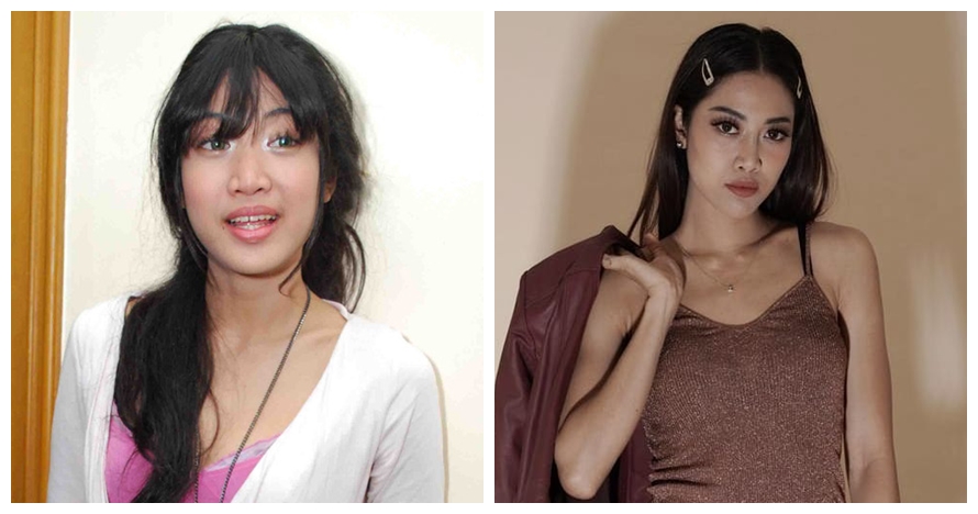 Potret 9 penyanyi sebelum dan sesudah tanam benang, pipi makin tirus