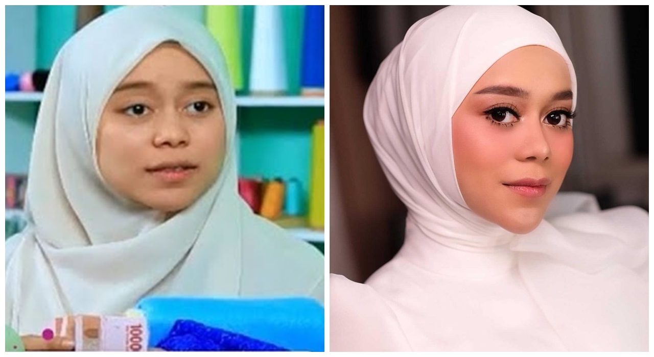 Potret 9 penyanyi sebelum dan sesudah tanam benang, pipi makin tirus