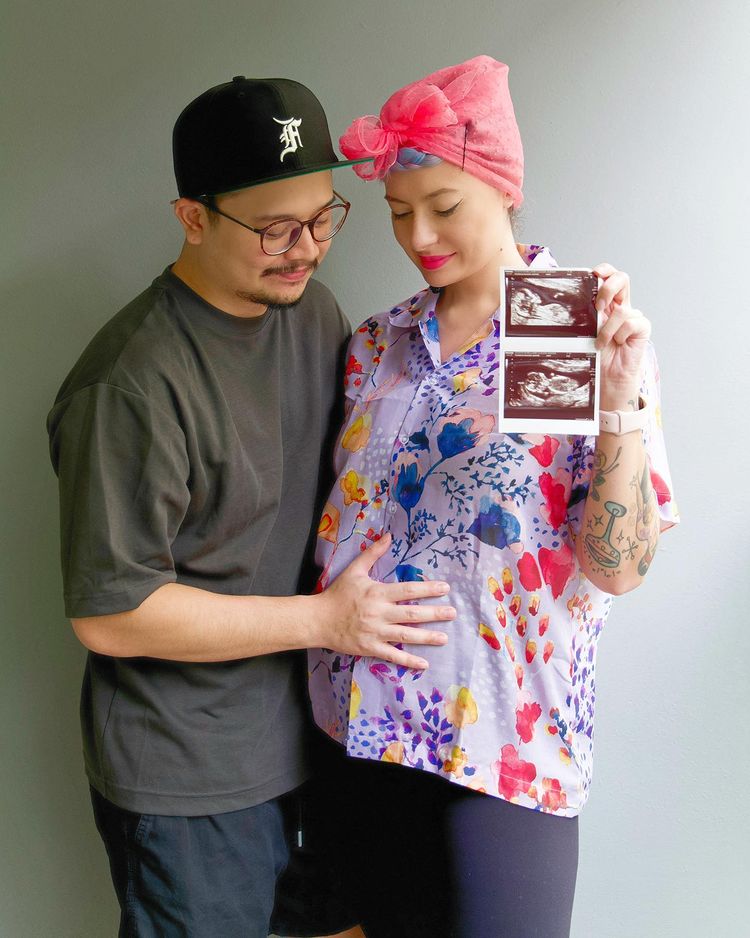 11 Potret terbaru Derby Romero dan Istri, pilih menetap di Singapura