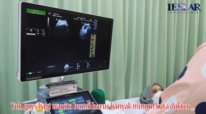 11 Momen Lesty Kejora cek kandungan, hasil USG bikin deg-degan