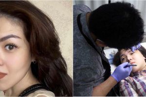 7 Jenis perawatan kecantikan Tina Toon, dari botox hingga sulam bibir