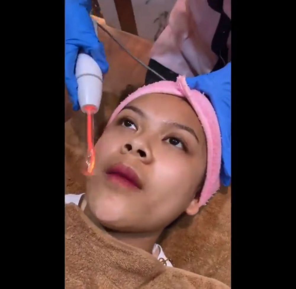 7 Perawatan ini rahasia cantik Meli LIDA, botox hingga infus whitening