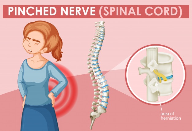 5 Fakta Spinal Cord Injury yang diderita Laura Anna sebelum berpulang