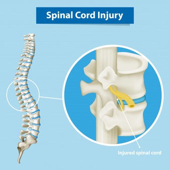 5 Fakta Spinal Cord Injury yang diderita Laura Anna sebelum berpulang
