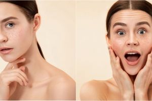 9 Daun penghilang flek hitam di wajah dan cara menggunakannya