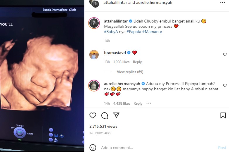 Atta Halilintar unggah foto USG bayinya, pipi chubby jadi sorotan