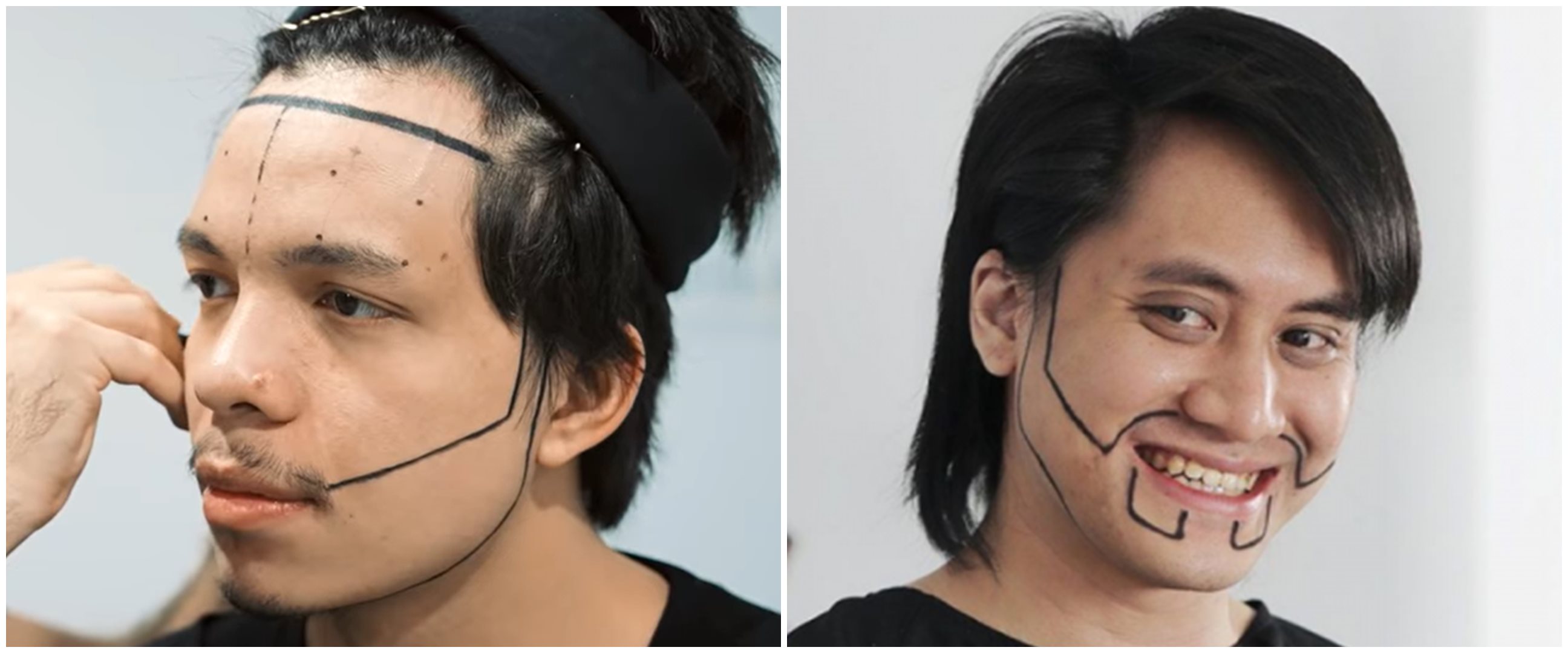 Penampilan 6 seleb usai transplantasi rambut, Atta Halilintar makin PD