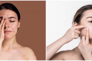 7 Manfaat serum Hanasui pink, bantu hilangkan jerawat wajah