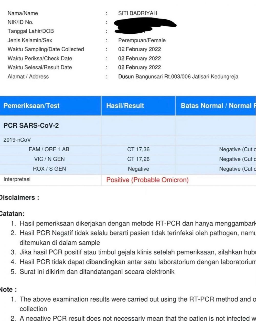 Siti Badriah positif Omicron saat hamil 7 bulan, begini kondisinya