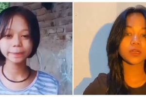 Lakukan filler hidung, ini 11 potret dulu dan kini Cimoy Montok