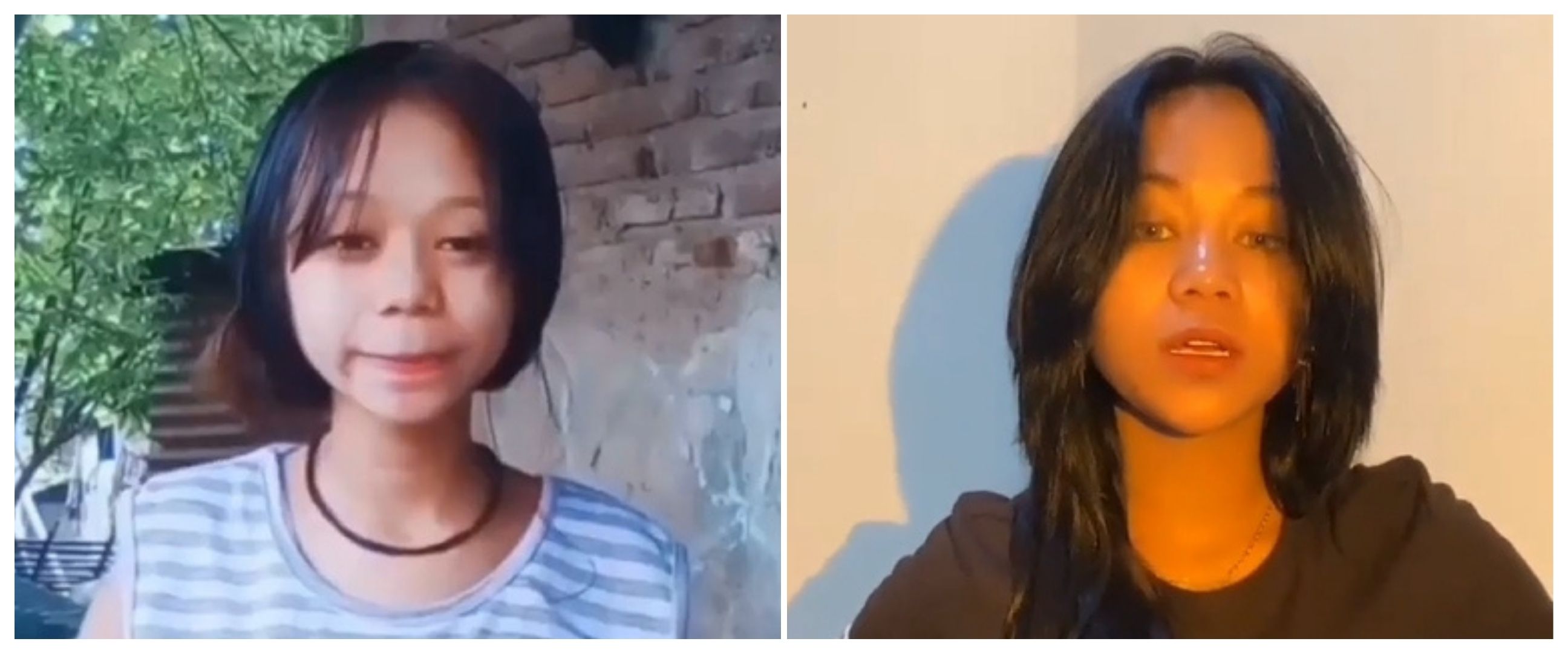 Lakukan filler hidung, ini 11 potret dulu dan kini Cimoy Montok