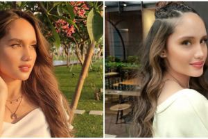 Cara Cinta Laura samarkan noda hitam menahun dalam dua minggu