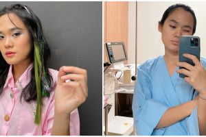  Alami saraf terjepit, Sheryl Sheinafia ceritakan kronologinya