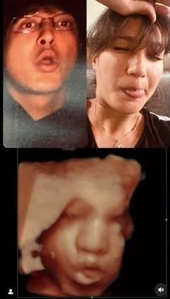 Nadine Chandrawinata unggah foto USG, hidung bayi jadi sorotan