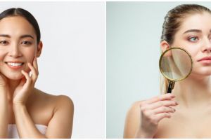 7 Manfaat belimbing wuluh untuk wajah, basmi noda membandel