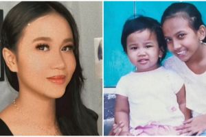 9 Potret masa kecil Mayang adik Vanessa Angel, giginya mirip Gala