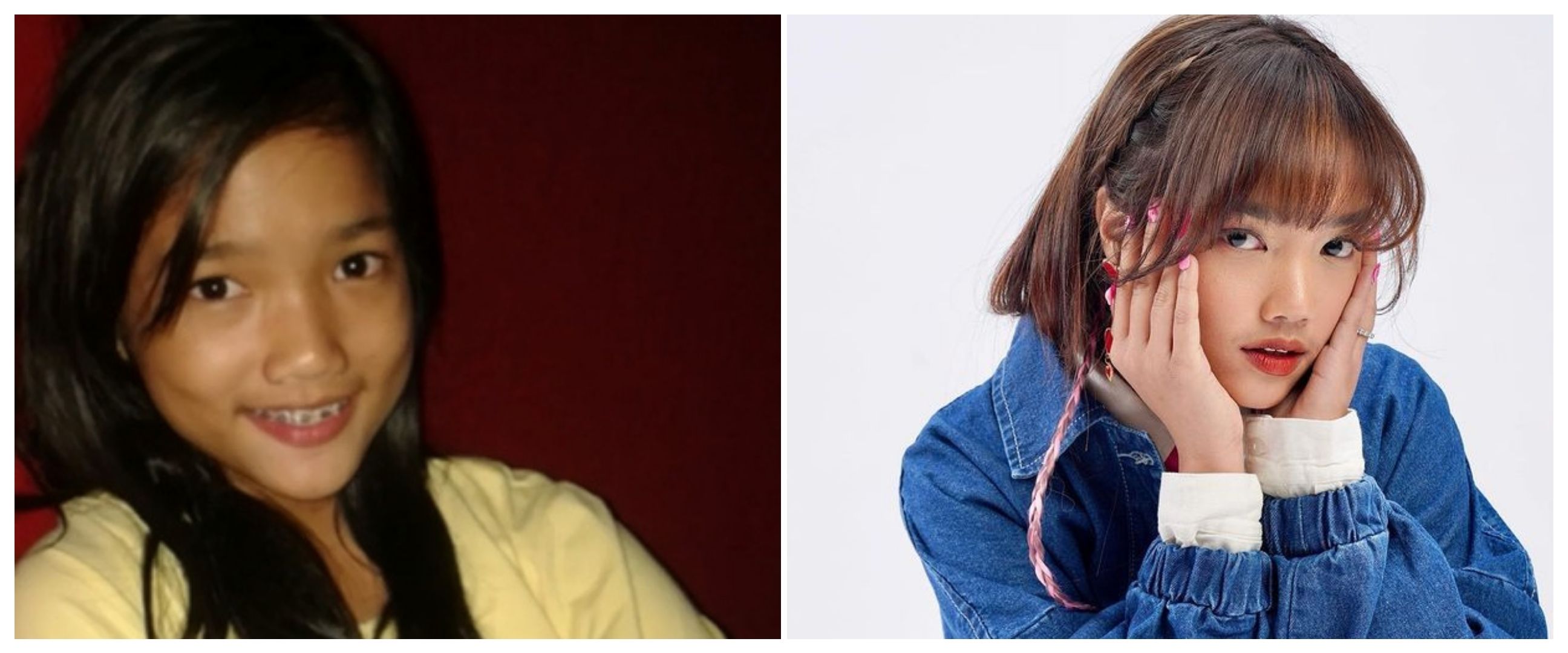 11 Potret jadul Fuji, pernah jerawatan parah dan pasang behel