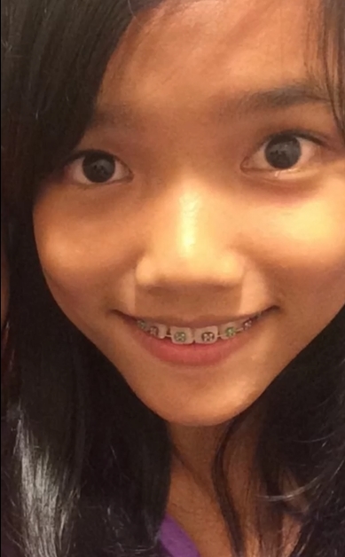 11 Potret jadul Fuji, pernah jerawatan parah dan pasang behel