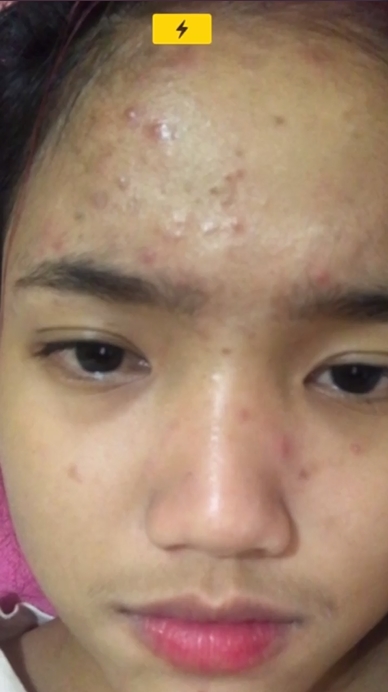 11 Potret jadul Fuji, pernah jerawatan parah dan pasang behel