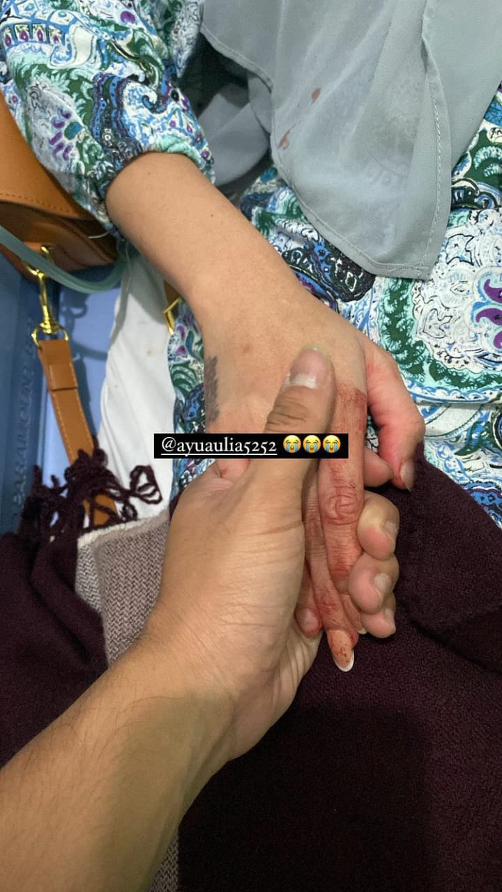 7 Potret kondisi terbaru Ayu Aulia, terbaring di rumah sakit