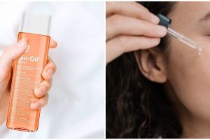 5 Manfaat Bio Oil untuk wajah, mampu atasi bekas jerawat