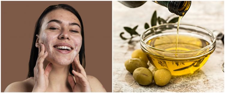 7 Cara mengatasi kulit wajah kering bersisik, mudah dan simpel