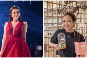 5 Cara merawat wajah agar putih seperti Gisella, pakai hydrafacial