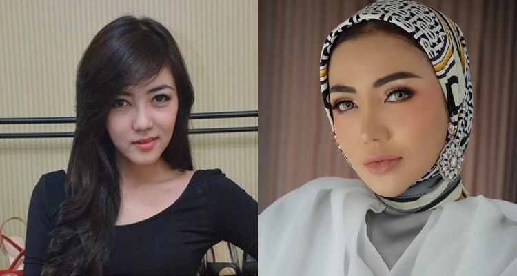 Transformasi 9 seleb setelah operasi plastik, Mawar AFI bikin pangling