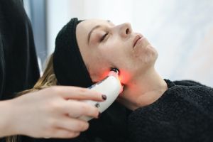5 Manfaat picosure laser, bisa menstimulasi produksi kolagen