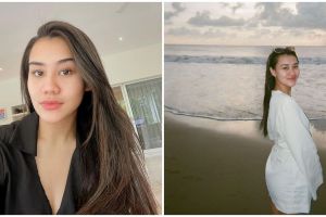 5 Tips kulit cantik Aaliyah Massaid, andalkan infus pemutih