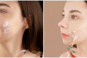 9 Skincare untuk menghilangkan bekas jerawat di bawah Rp 150 ribu