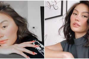 5 Rahasia kecantikan Agnez Mo, kulit kencang dari perawatan coolaser