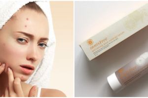 7 Serum Korea untuk mengatasi jerawat, harga mulai Rp 130 ribu