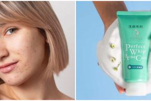 7 Skincare lokal untuk hilangkan bekas jerawat, di bawah Rp 100 ribu