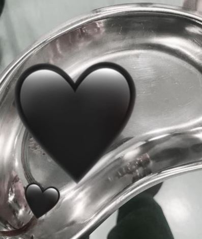 Dinda Hauw ungkap kronologi keguguran anak kembar, alami pendarahan