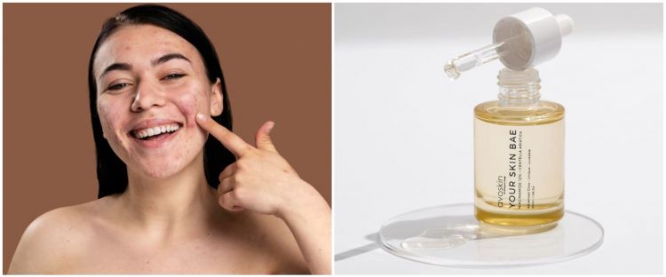 7 Serum lokal untuk mengecilkan pori-pori wajah, di bawah Rp 200 ribu