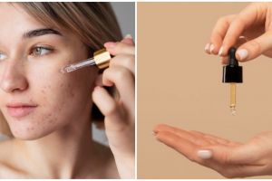 Rekomendasi 11 serum kulit berminyak & berjerawat mulai Rp 30 ribuan