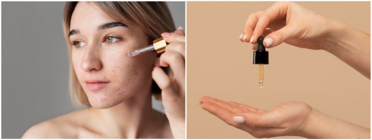 Rekomendasi 11 serum kulit berminyak & berjerawat mulai Rp 30 ribuan