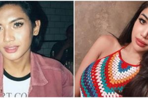 11 Transformasi Millen Cyrus, paras usai filler bibir jadi sorotan