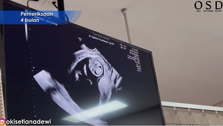 7 Momen Ria Ricis cek kandungan, wajah sang bayi bikin penasaran